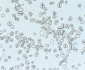 印刷 アブラナ 花粉 顕微鏡 テンダウォール