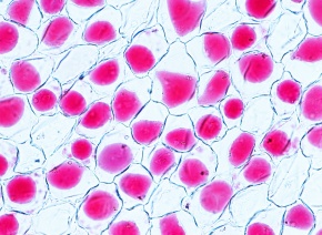 原形質分離 Corvet Photo Agency