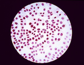 観察倍率400倍の視野 Corvet Photo Agency