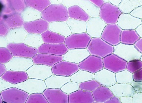 原形質分離 Corvet Photo Agency