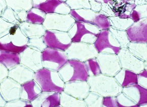 原形質分離 Corvet Photo Agency