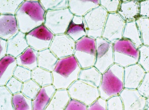 原形質分離 Corvet Photo Agency