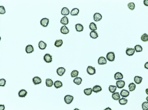 ヒカゲノカズラ　　しー様 楽天市場】ヒカゲノカズラの通販
