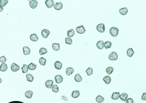 ヒカゲノカズラ科 | Corvet Photo Agency