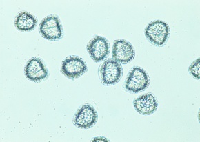 ヒカゲノカズラ属 | Corvet Photo Agency