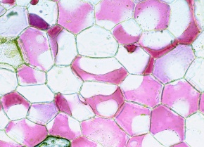 原形質分離 Corvet Photo Agency