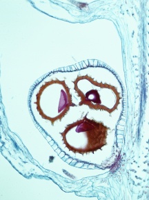 胞子嚢 | Corvet Photo Agency