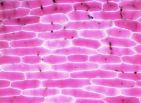 原形質分離 Corvet Photo Agency