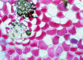 原形質分離 Corvet Photo Agency