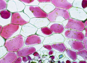 原形質分離 Corvet Photo Agency