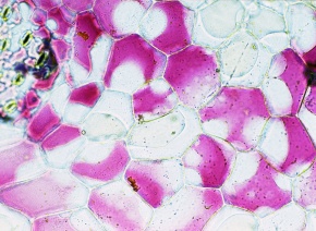 原形質分離 Corvet Photo Agency