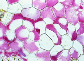 原形質分離 Corvet Photo Agency