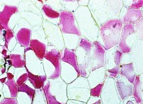 原形質分離 Corvet Photo Agency