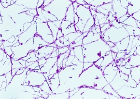 ミラビレ　写真確認用 倍率20 | Corvet Photo Agency