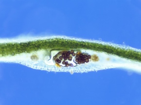 胞子嚢 | Corvet Photo Agency