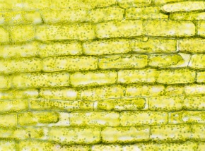 オオカナダモの原形質復帰の写真を見る Corvet Photo Agency オオカナダモの原形質復帰の写真を見る Corvet Photo Agency